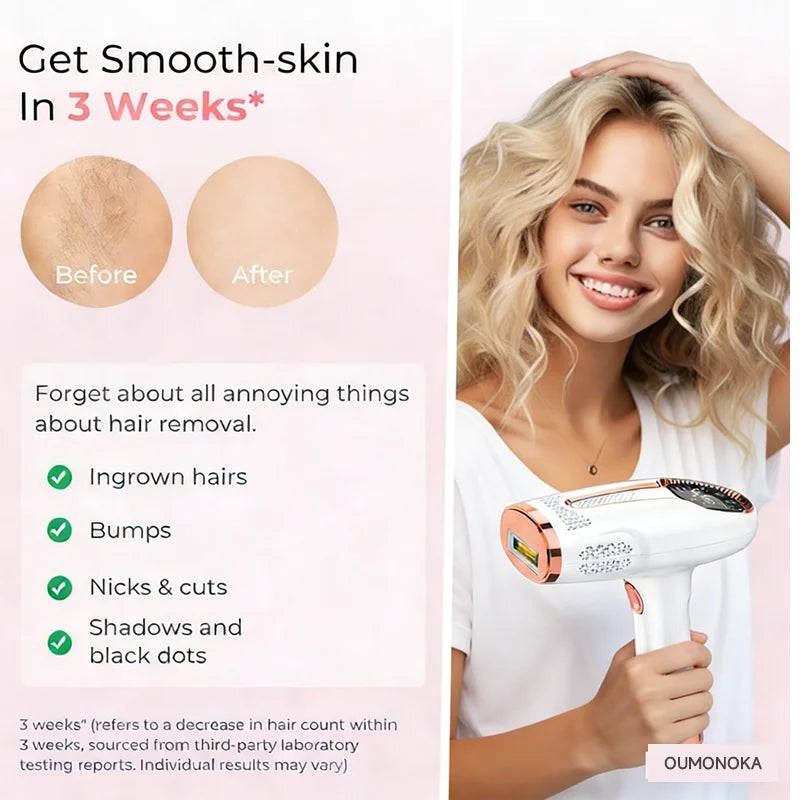 IPL Permanent Laser Hair Removal Choice Beauty Women's Shaver Bikini Care Appliances Facial Massage Photoepilator Laser Epilator