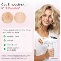 IPL Permanent Laser Hair Removal Choice Beauty Women's Shaver Bikini Care Appliances Facial Massage Photoepilator Laser Epilator