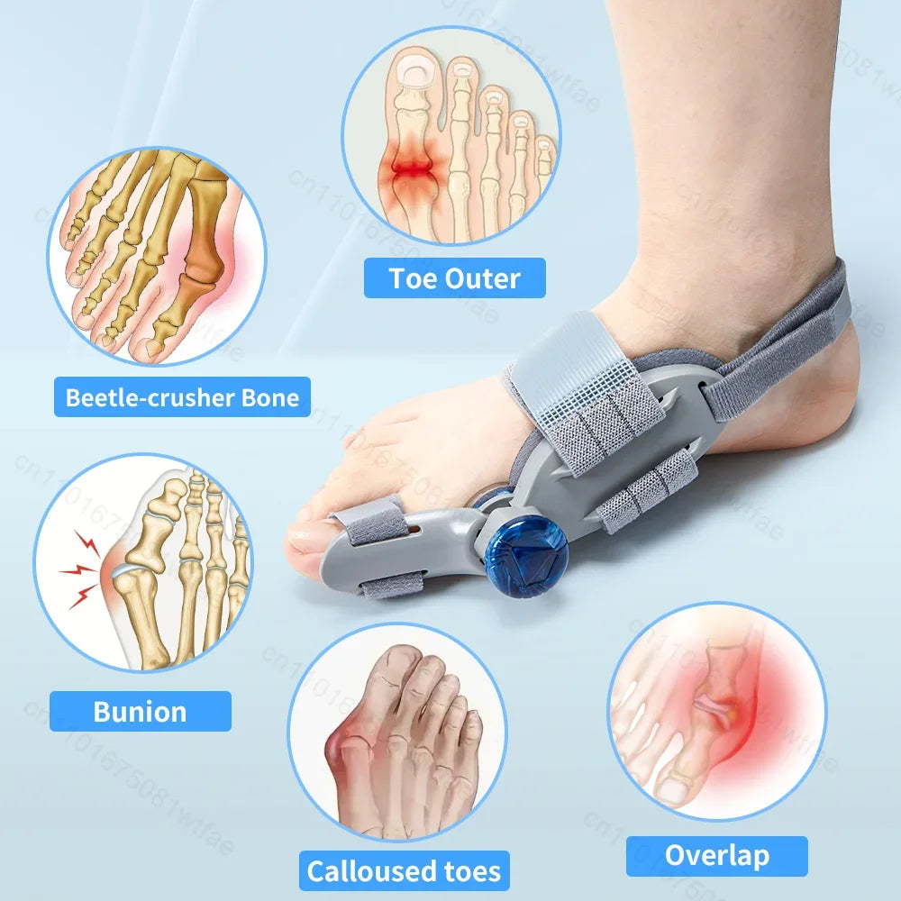 1pcs Bunion Corrector Hallux Valgus Braces Toe Separator Straightener Pain Relief Toe Valgus Corrector Orthopedic Pedicure